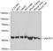 Ubiquinol-Cytochrome C Reductase Core Protein 2 antibody, GTX33573, GeneTex, Western Blot image 