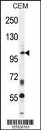 Inositol Polyphosphate-5-Phosphatase B antibody, 55-215, ProSci, Western Blot image 