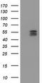 Cytochrome P450 Family 2 Subfamily C Member 9 antibody, TA503776S, Origene, Western Blot image 