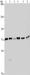 Lysyl-TRNA Synthetase antibody, TA350109, Origene, Western Blot image 