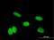 Homeobox A11 antibody, H00003207-M07, Novus Biologicals, Immunofluorescence image 