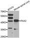 Paired Box 2 antibody, TA327502, Origene, Western Blot image 