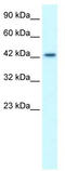 LIM Homeobox 3 antibody, TA334210, Origene, Western Blot image 