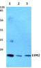 LSM2 Homolog, U6 Small Nuclear RNA And MRNA Degradation Associated antibody, A07586, Boster Biological Technology, Western Blot image 