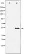 NFKB Inhibitor Beta antibody, TA325733, Origene, Western Blot image 