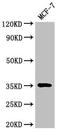 Aspartoacylase-2 antibody, orb400700, Biorbyt, Western Blot image 