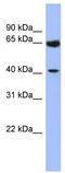 Ceramide Synthase 2 antibody, TA345355, Origene, Western Blot image 