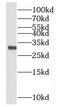 Nuclear Receptor Interacting Protein 2 antibody, FNab05857, FineTest, Western Blot image 