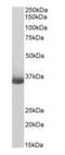CD20 antibody, orb334081, Biorbyt, Western Blot image 