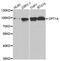 Carnitine Palmitoyltransferase 1A antibody, TA332600, Origene, Western Blot image 