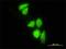 DnaJ Heat Shock Protein Family (Hsp40) Member C3 antibody, H00005611-M01, Novus Biologicals, Immunocytochemistry image 