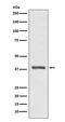 Protein Kinase AMP-Activated Non-Catalytic Subunit Beta 1 antibody, M03741, Boster Biological Technology, Western Blot image 