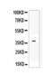 Dickkopf WNT Signaling Pathway Inhibitor 1 antibody, A00632, Boster Biological Technology, Western Blot image 