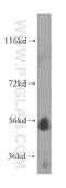 UDP Glucuronosyltransferase Family 2 Member B4 antibody, 15425-1-AP, Proteintech Group, Western Blot image 