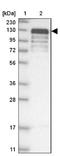 NHS Like 1 antibody, NBP1-90025, Novus Biologicals, Western Blot image 
