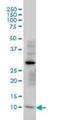 Translocase Of Inner Mitochondrial Membrane 8A antibody, H00001678-M01, Novus Biologicals, Western Blot image 