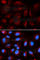 Protein Inhibitor Of Activated STAT 2 antibody, A5654, ABclonal Technology, Immunofluorescence image 
