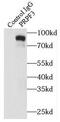 Pre-MRNA Processing Factor 3 antibody, FNab06814, FineTest, Immunoprecipitation image 