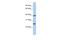 Chromosome 12 Open Reading Frame 42 antibody, A18127, Boster Biological Technology, Western Blot image 