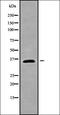 Homeobox protein SIX3 antibody, orb338387, Biorbyt, Western Blot image 