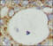 Tumor Necrosis Factor antibody, 251900, Abbiotec, Immunohistochemistry paraffin image 
