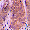 Histone Deacetylase 5 antibody, LS-C353222, Lifespan Biosciences, Immunohistochemistry frozen image 