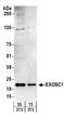 Exosome Component 1 antibody, A303-885A, Bethyl Labs, Western Blot image 