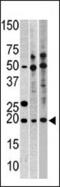 Ribosomal Protein L23a antibody, 60-522, ProSci, Western Blot image 