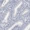 Sperm Acrosome Associated 1 antibody, HPA026744, Atlas Antibodies, Immunohistochemistry paraffin image 