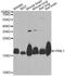Visinin-like protein 1 antibody, A6999, ABclonal Technology, Western Blot image 