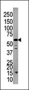 Protein Phosphatase 3 Catalytic Subunit Gamma antibody, AP15297PU-N, Origene, Western Blot image 