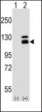 Poly(ADP-ribose) glycohydrolase antibody, LS-C100859, Lifespan Biosciences, Western Blot image 
