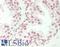 ZFP91 Zinc Finger Protein antibody, LS-B14788, Lifespan Biosciences, Immunohistochemistry paraffin image 
