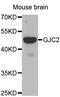 Gap Junction Protein Gamma 2 antibody, STJ23796, St John