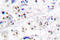 Minichromosome Maintenance Complex Component 5 antibody, LS-C176113, Lifespan Biosciences, Immunohistochemistry paraffin image 