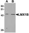 LIM homeobox transcription factor 1-beta antibody, TA319063, Origene, Western Blot image 