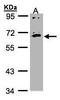 Interleukin 17 Receptor C antibody, TA308112, Origene, Western Blot image 