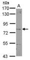 Dystrobrevin beta antibody, NBP2-16246, Novus Biologicals, Western Blot image 