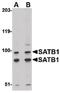 DNA-binding protein SATB1 antibody, PA5-20534, Invitrogen Antibodies, Western Blot image 