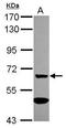 Alpha-1,3-Mannosyl-Glycoprotein 4-Beta-N-Acetylglucosaminyltransferase A antibody, GTX119640, GeneTex, Western Blot image 