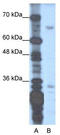 Zinc Finger Protein 691 antibody, TA329895, Origene, Western Blot image 