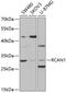 DSC1 antibody, 19-590, ProSci, Western Blot image 