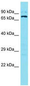 Sosondowah Ankyrin Repeat Domain Family Member B antibody, TA334867, Origene, Western Blot image 