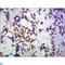 Transducin Beta Like 1 X-Linked Receptor 1 antibody, LS-C813132, Lifespan Biosciences, Immunohistochemistry paraffin image 