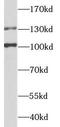 Zinc Finger E-Box Binding Homeobox 2 antibody, FNab09954, FineTest, Western Blot image 
