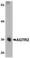 Angiotensin II Receptor Type 2 antibody, NBP1-77368, Novus Biologicals, Western Blot image 