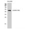 BLNK antibody, LS-C381276, Lifespan Biosciences, Western Blot image 