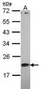 Calt antibody, GTX114316, GeneTex, Western Blot image 