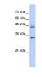 Proline And Arginine Rich End Leucine Rich Repeat Protein antibody, NBP1-79627, Novus Biologicals, Western Blot image 