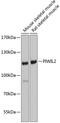 Piwi Like RNA-Mediated Gene Silencing 2 antibody, 19-986, ProSci, Western Blot image 